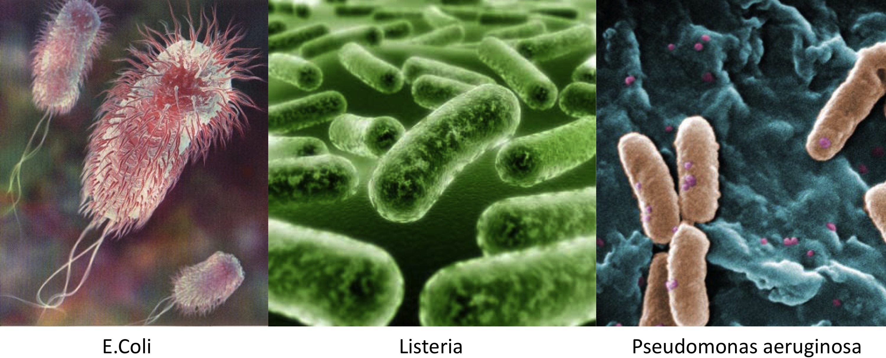 http://bioniusa.files.wordpress.com/2011/02/e-coli-listeria.jpg